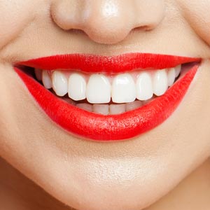 FindOutHowTheseFamousCelebritiesProtectTheirSmilesFromTeethGrinding