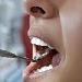 Metal Versus Porcelain Dental Materials