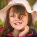 Do You Have Congenitally Missing Teeth?  