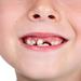 Tooth Replacement Options